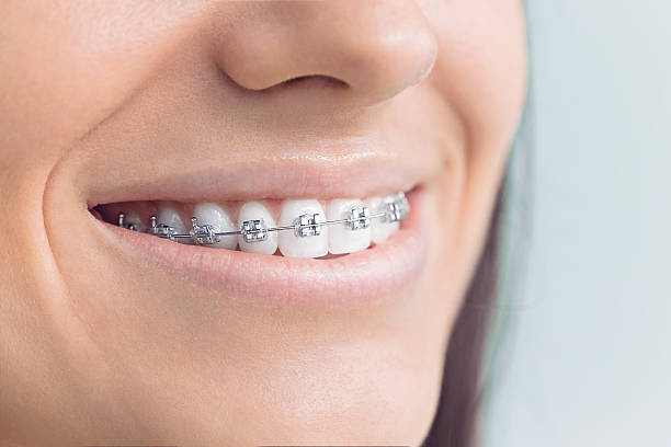 Best Veneers and Lumineers  in South Burlington, VT